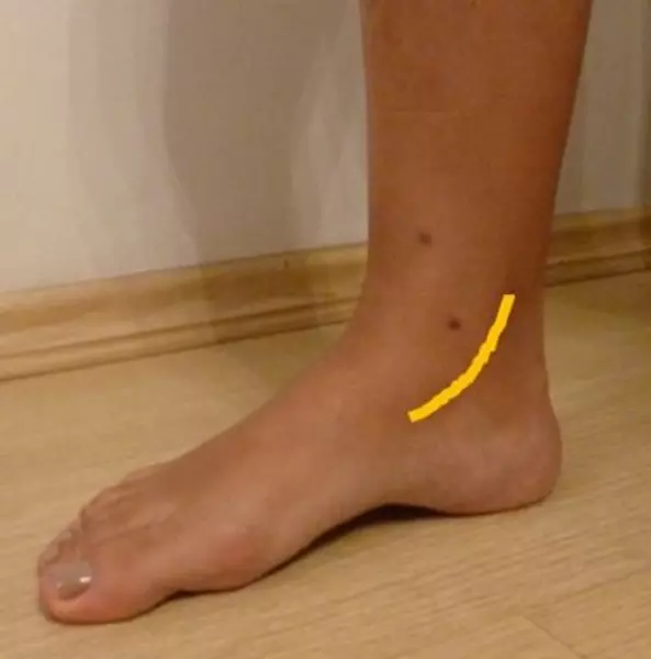Trajeto do Tendão Tibial Posterior